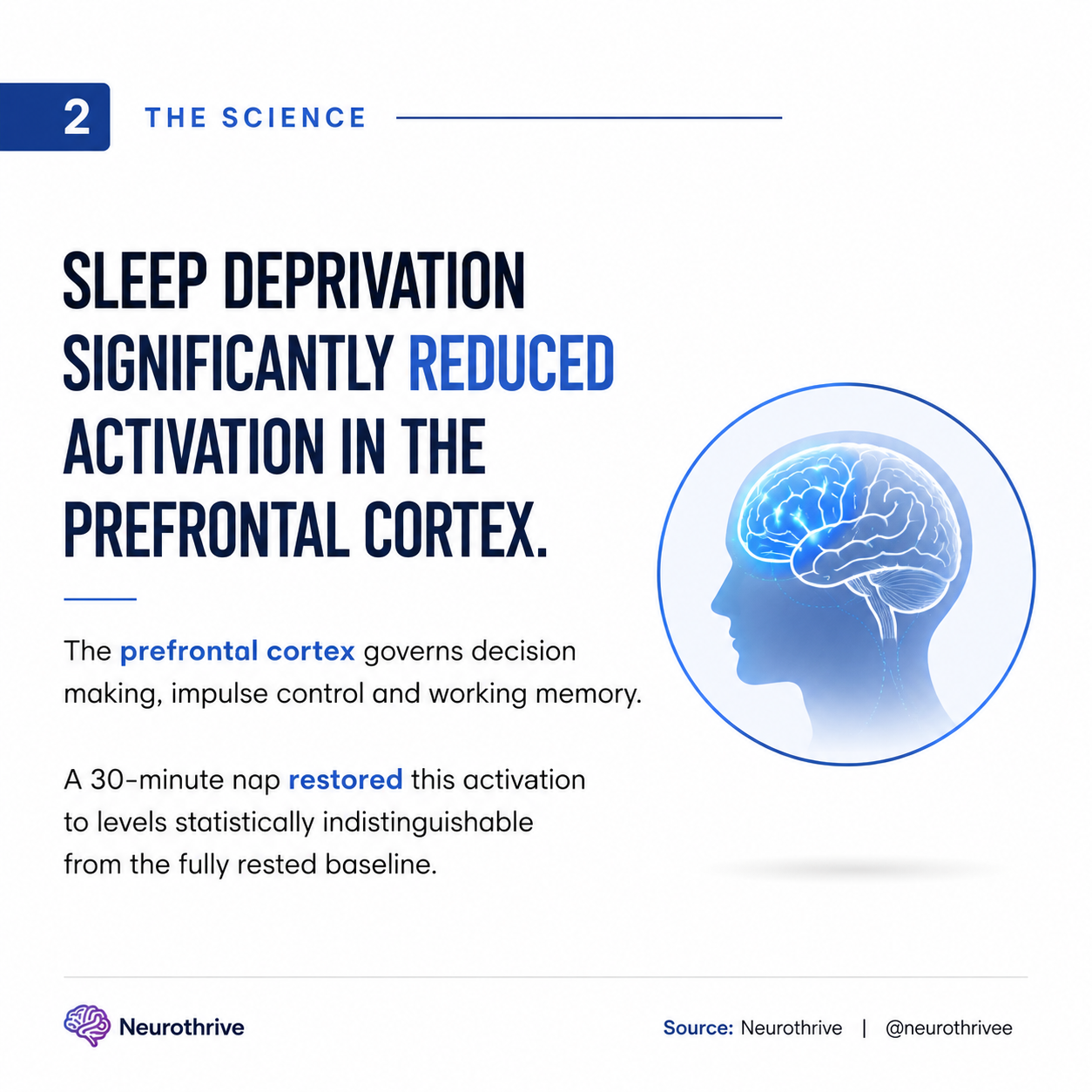 Sometimes our brain just needs a 30-minute nap.
