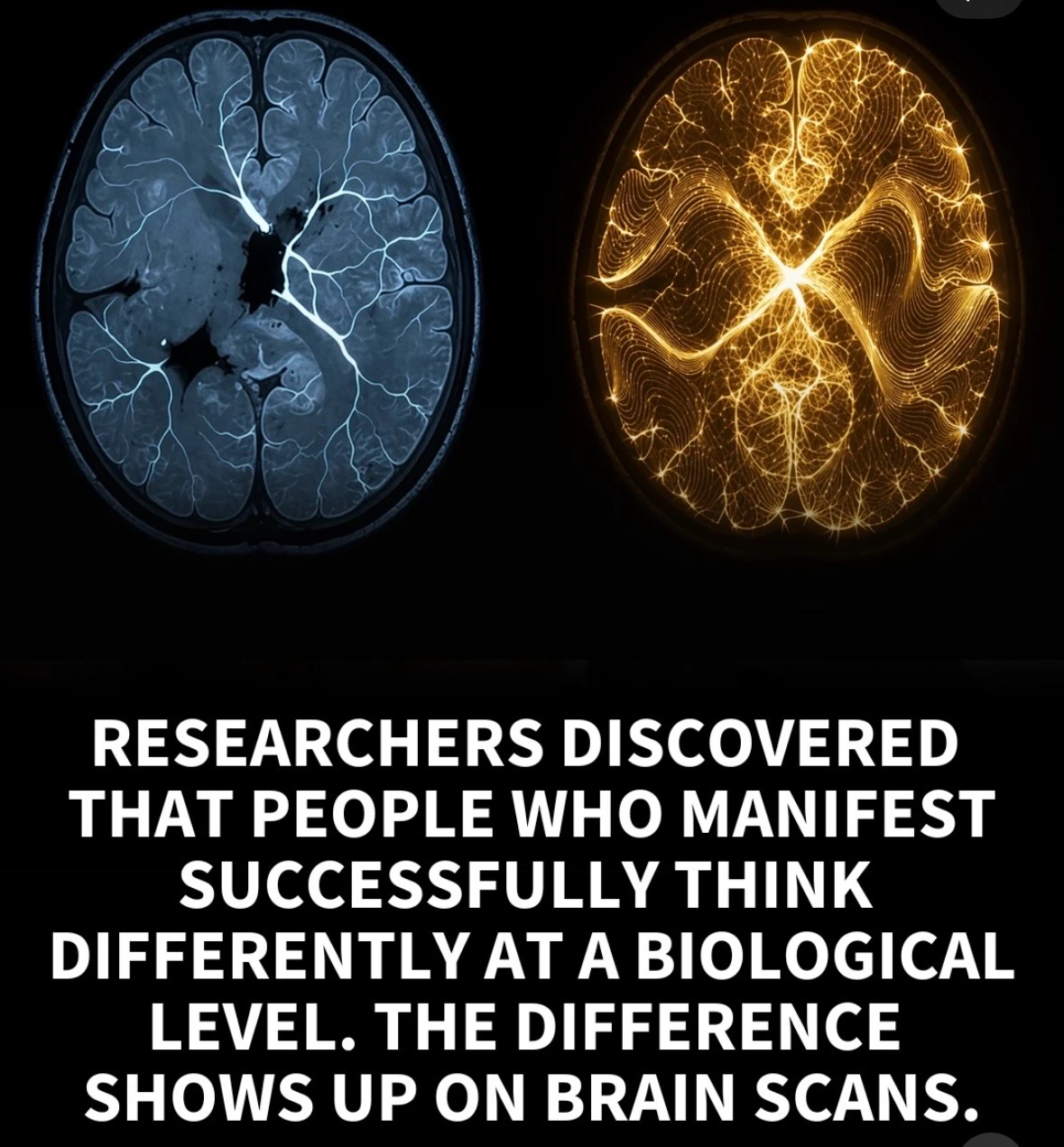 The brain and manifestation