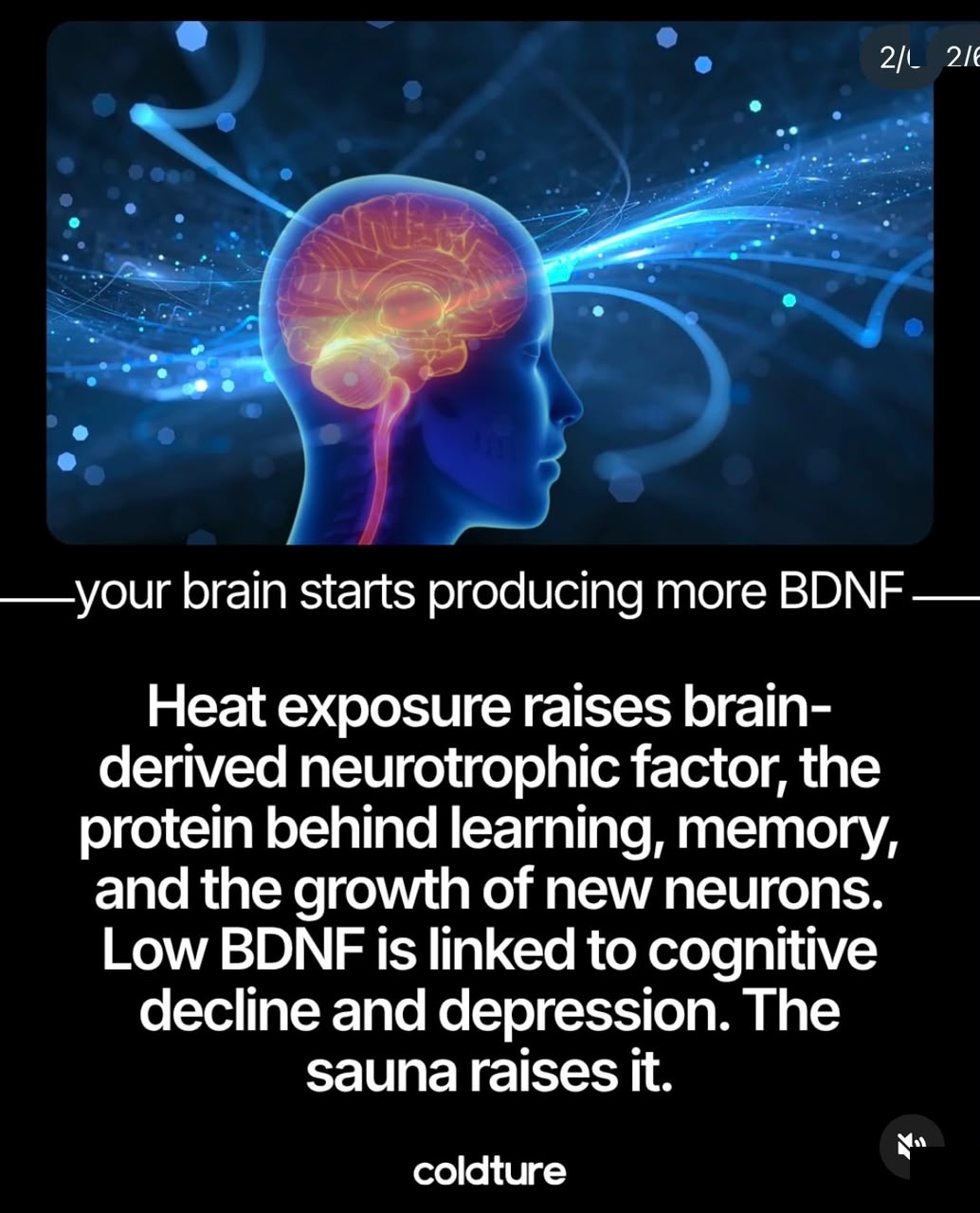 02_BDNF.jpg